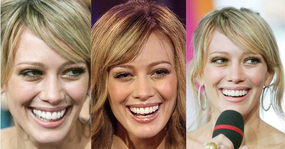 Hilary Duff Before & After: Smile Upgrade?