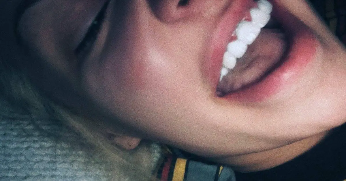 Tana Mongeau's Tooth Trouble: Veneers or Crowns?