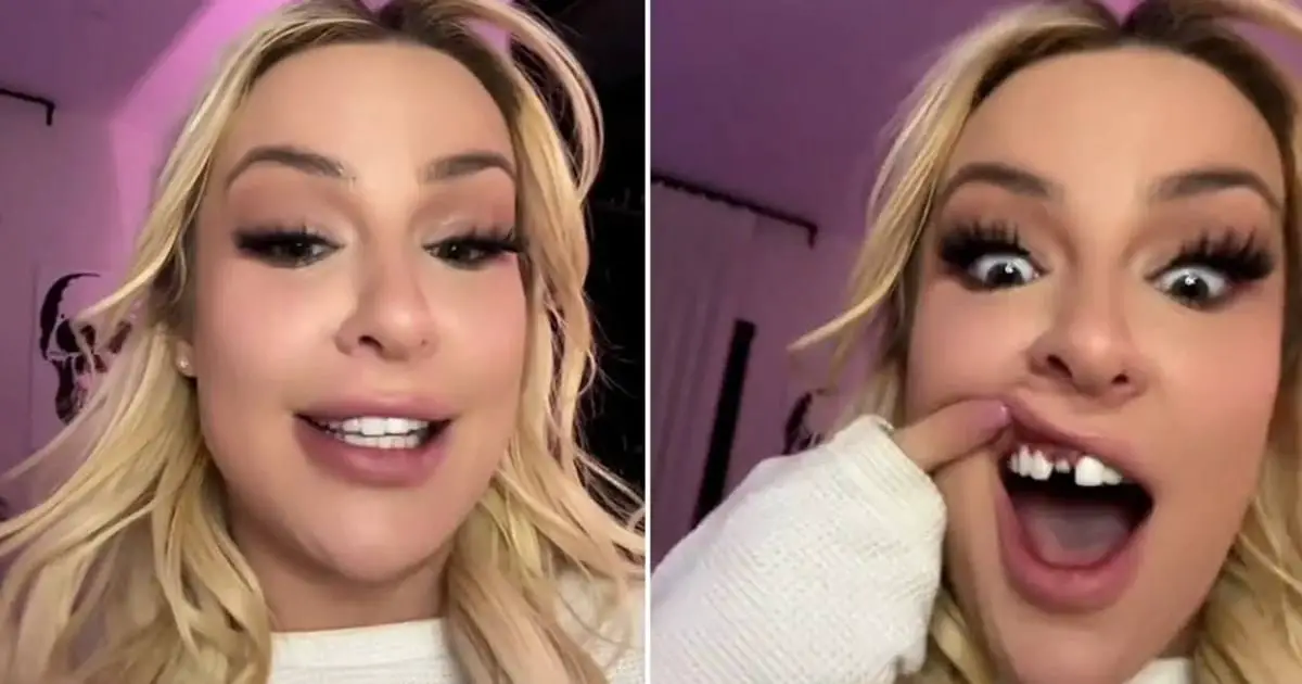 Tana Mongeau's Tooth Trouble: Veneers or Crowns?