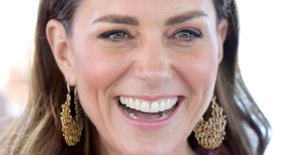 Catherine, Princess of Wales' Teeth: Veneers or Natural?