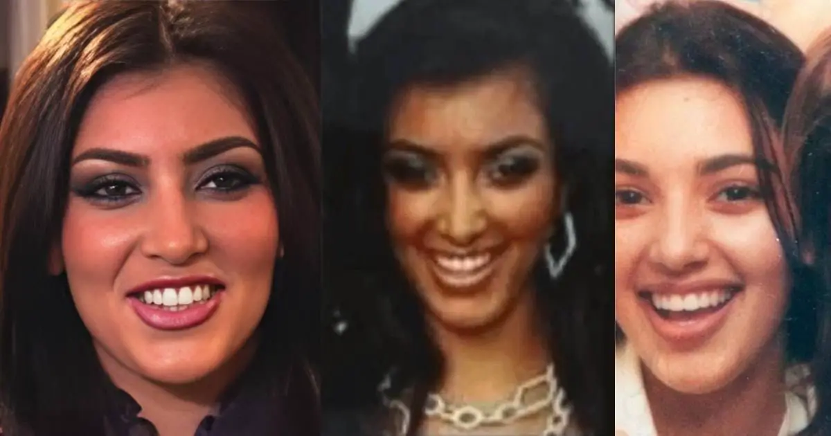 Kim Kardashian Teeth Before Veneers