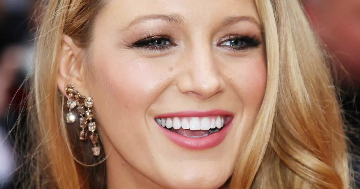 Blake Lively's Perfect Teeth: Fact or Veneers?