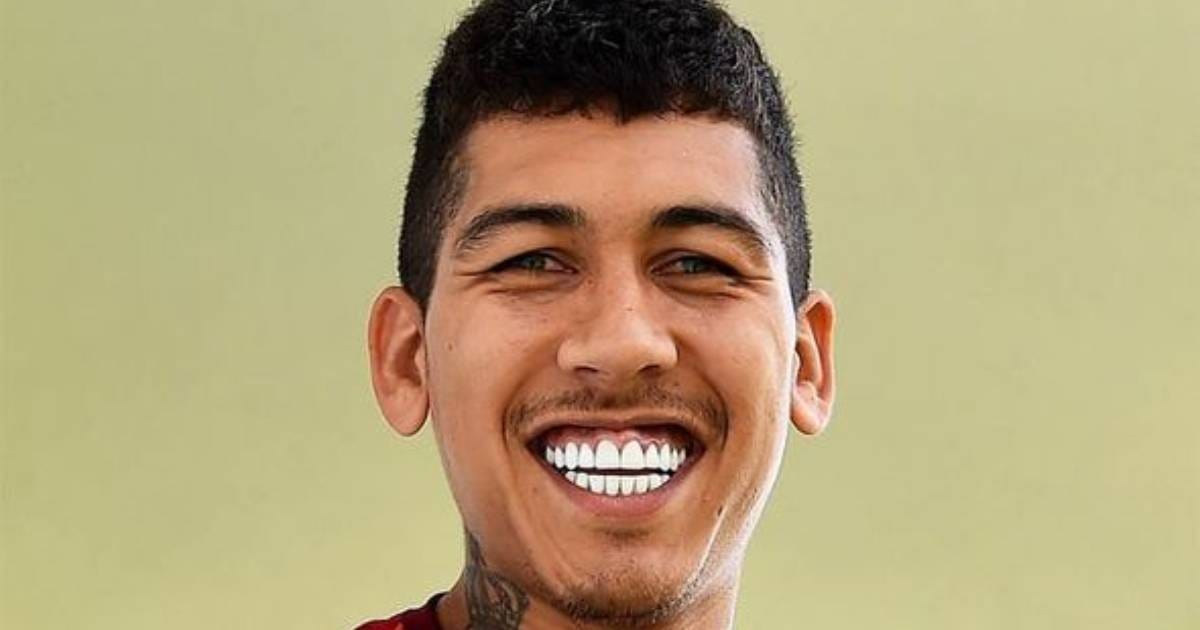 Roberto Firmino's Veneers: The Story of 