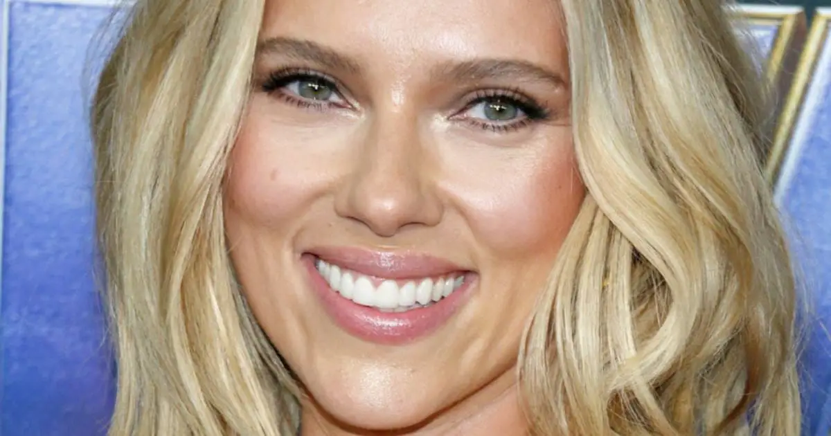 Scarlett Johansson's Smile: From Natural Beauty to Veneers