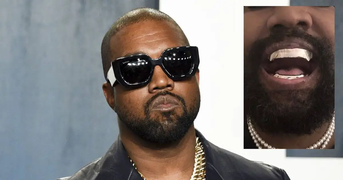 Kanye West's Teeth: Debunking the Titanium Denture Myth