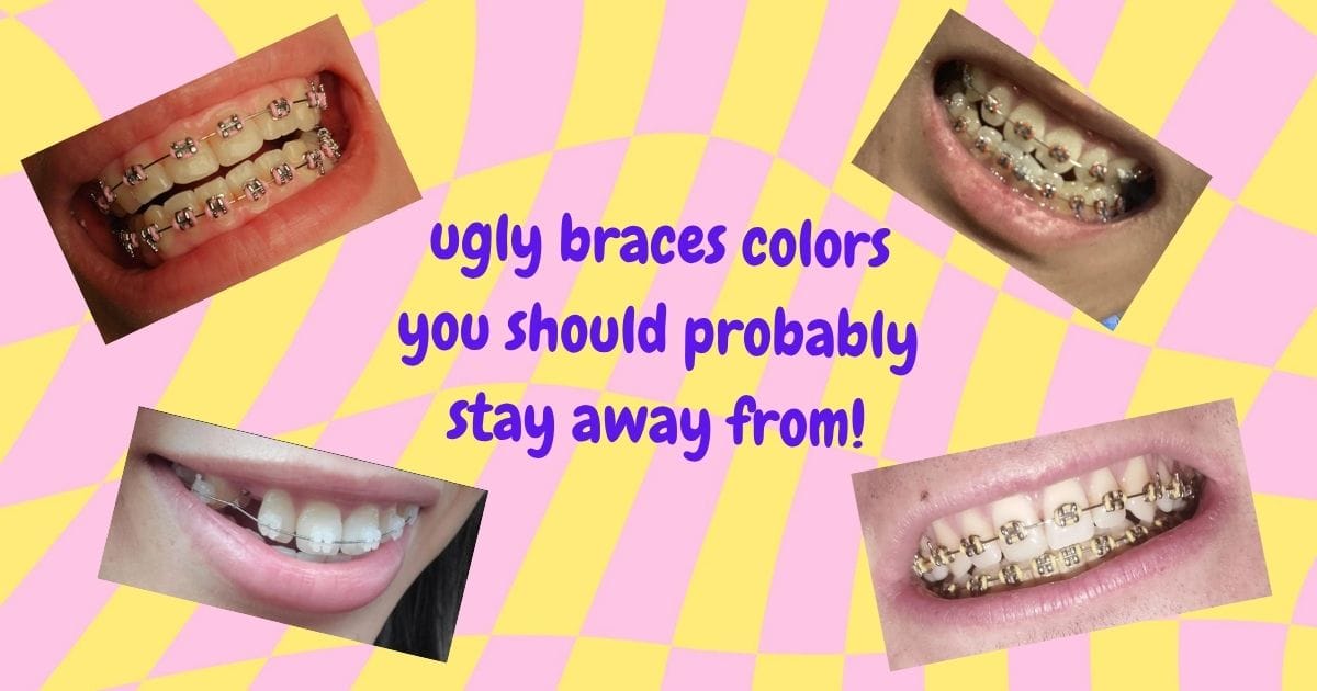 Ugly Braces Colors: The Ultimate Guide to Colors You Should Never Get 🚫😬