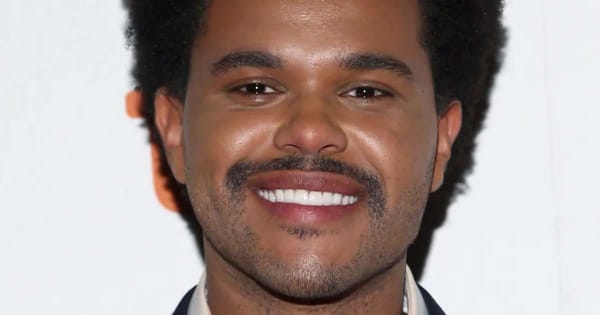 The Weeknd's Smile Secrets: Does He Have Veneers?