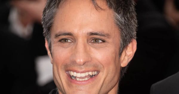 Does Gael Garcia Bernal Have Veneers? A Dentist's Analysis