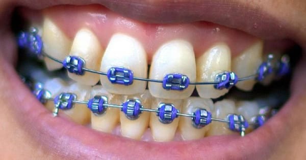 Purple Braces: Lavender to Violet Style Guide