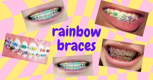 Rainbow Braces: Ultimate Guide to Multicolor Braces Magic
