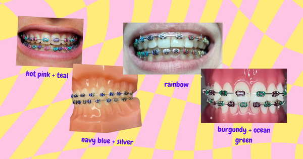 Best Braces Color Combinations: The Ultimate Guide for 2025