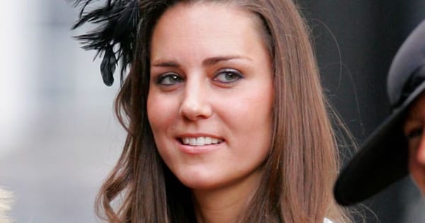 Kate Middleton's Royal Smile: Veneers or Masterful Orthodontics?