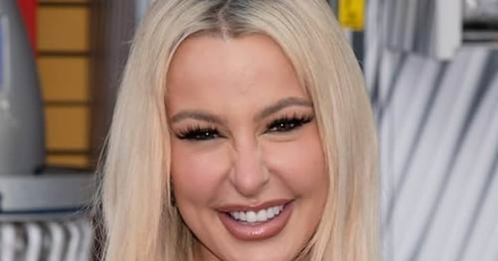 Tana Mongeau's Tooth Trouble: Veneers or Crowns?